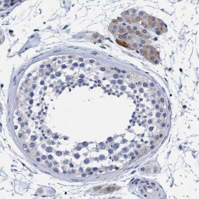 Immunohistochemistry-Paraffin: CROCC Antibody [NBP1-80821]