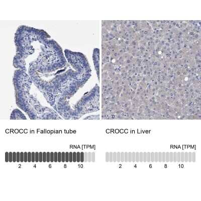 Immunohistochemistry-Paraffin: CROCC Antibody [NBP1-80821]