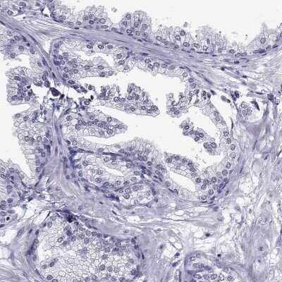 Immunohistochemistry-Paraffin: CROCC2 Antibody [NBP2-14651]