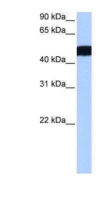 Western Blot: CROCCL2 Antibody [NBP1-79470]