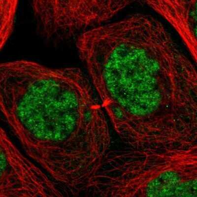 Immunocytochemistry/ Immunofluorescence: CROP Antibody [NBP1-88051]