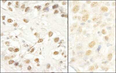 Immunohistochemistry: CROP Antibody [NB100-74625]