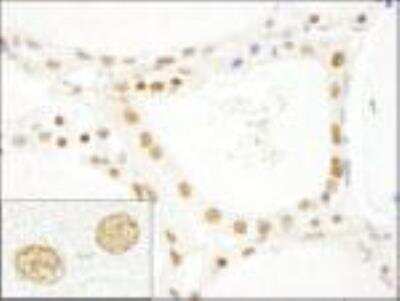 Immunohistochemistry-Paraffin: CROP Antibody [NB100-74625]