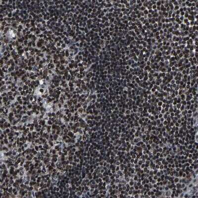 Immunohistochemistry-Paraffin: CROP Antibody [NBP1-88051]