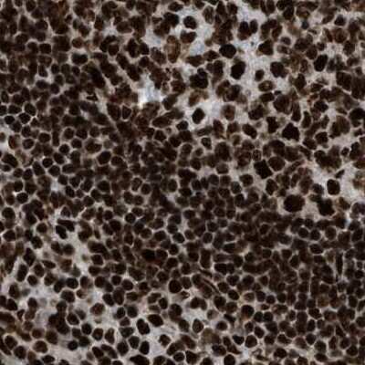 Immunohistochemistry-Paraffin: CROP Antibody [NBP1-88052]