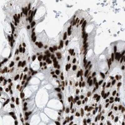 Immunohistochemistry-Paraffin: CROP Antibody [NBP1-88052]