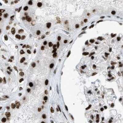 Immunohistochemistry-Paraffin: CROP Antibody [NBP1-88052]