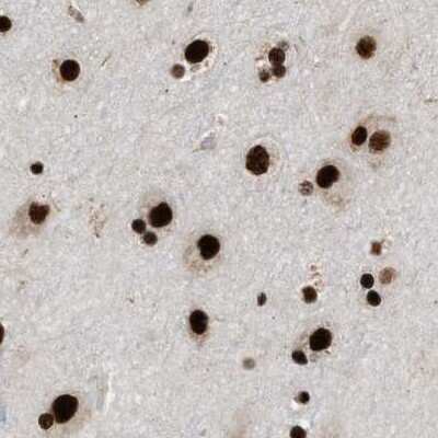 Immunohistochemistry-Paraffin: CROP Antibody [NBP1-88052]
