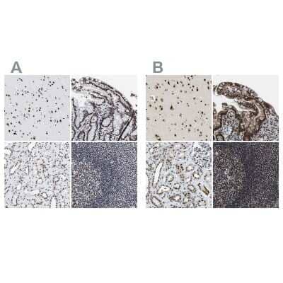 Immunohistochemistry-Paraffin: CROP Antibody [NBP1-88053]