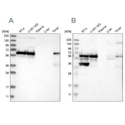 Western Blot: CROP Antibody [NBP1-88052]