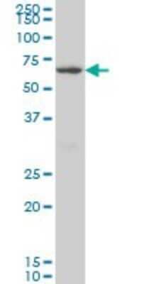 Western Blot: CROT Antibody (1A6) [H00054677-M01]