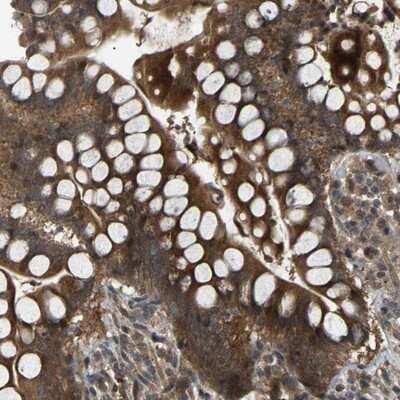 Immunohistochemistry-Paraffin: CROT Antibody [NBP1-85501]