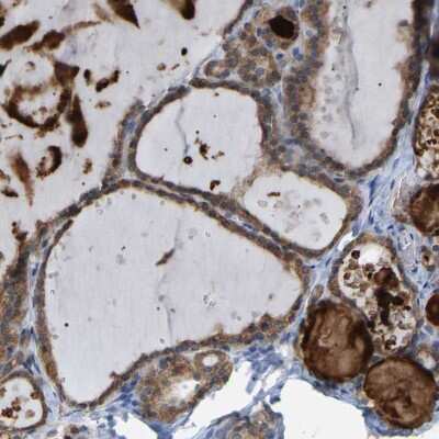 Immunohistochemistry-Paraffin: CROT Antibody [NBP1-85502]