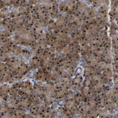 Immunohistochemistry-Paraffin: CROT Antibody [NBP1-85503]