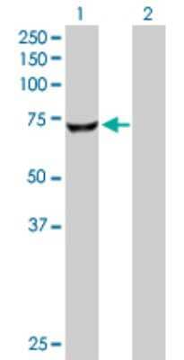 Western Blot: CROT Antibody [H00054677-D01P]