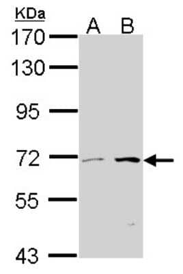 Western Blot: CROT Antibody [NBP1-31441]