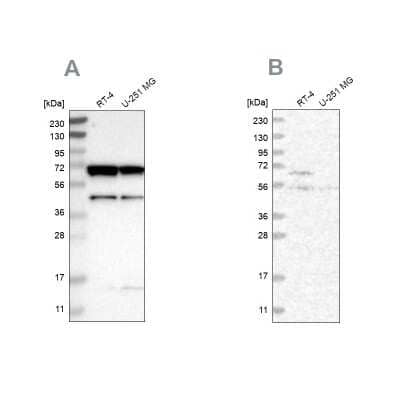 Western Blot: CROT Antibody [NBP1-85501]