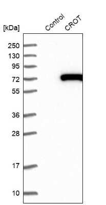 Western Blot: CROT Antibody [NBP1-85502]