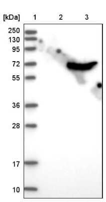 Western Blot: CROT Antibody [NBP1-85503]