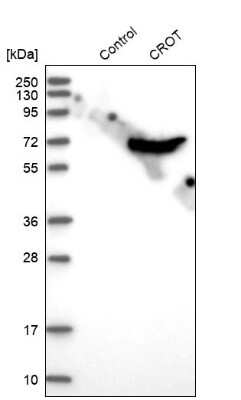 Western Blot: CROT Antibody [NBP1-85503]