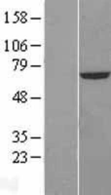 Western Blot: CROT Overexpression Lysate [NBL1-09489]