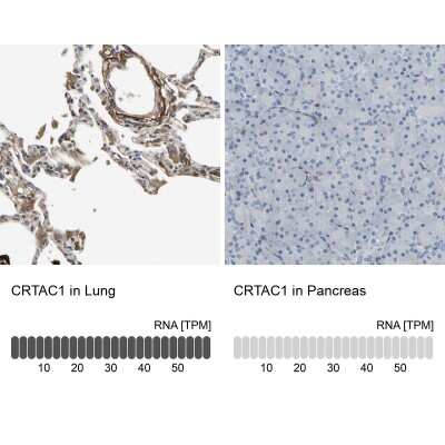 Immunohistochemistry-Paraffin: CRTAC1 Antibody [NBP1-88864]