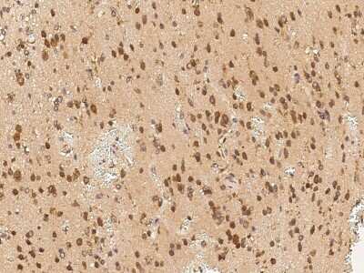 Immunohistochemistry-Paraffin: CRTAC1 Antibody [NBP2-98935]