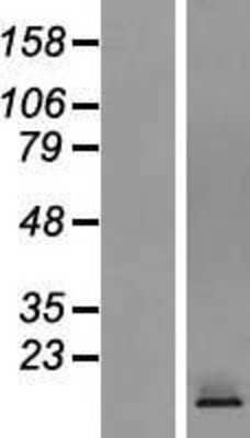 Western Blot: CRTAM Overexpression Lysate [NBP2-06714]