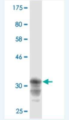 Western Blot: CRTAP Antibody (2G5) [H00010491-M02]