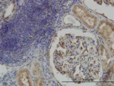 Immunohistochemistry-Paraffin: CRTAP Antibody (4D9) [H00010491-M01]