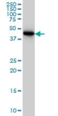 Western Blot: CRTAP Antibody (4D9) [H00010491-M01]