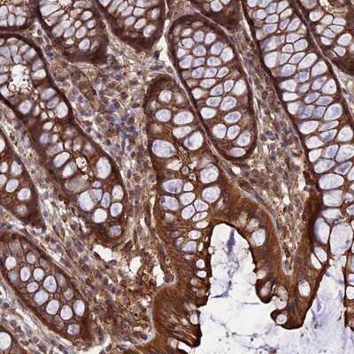 Immunohistochemistry-Paraffin: CRTAP Antibody [NBP1-94104]