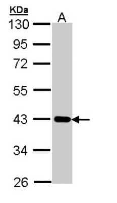 Western Blot: CRTAP Antibody [NBP1-32884]