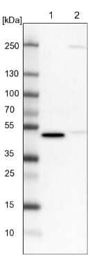 Western Blot: CRTAP Antibody [NBP1-94105]