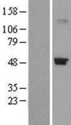 Western Blot: CRTAP Overexpression Lysate [NBL1-09491]