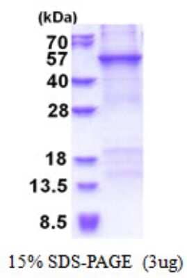 SDS-PAGE: Recombinant Human CRTAP His Protein [NBP2-51563]