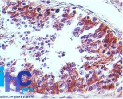 Immunohistochemistry: CRTH-2/GPR44 Antibody (54N3F8) - Azide and BSA Free [NBP2-80682]