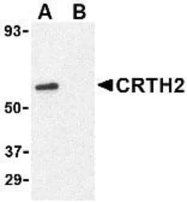 Western Blot: CRTH-2/GPR44 AntibodyBSA Free [NBP1-76755]