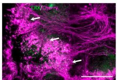 Immunocytochemistry/ Immunofluorescence: CRX/CORD2 Antibody (4G11) [H00001406-M02]
