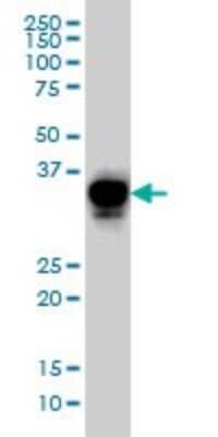 Western Blot: CRX/CORD2 Antibody (4G11) [H00001406-M02]