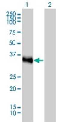 Western Blot: CRX/CORD2 Antibody (4G11) [H00001406-M02]