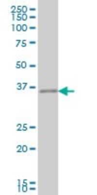 Western Blot: CRX/CORD2 Antibody (6D11) [H00001406-M04]