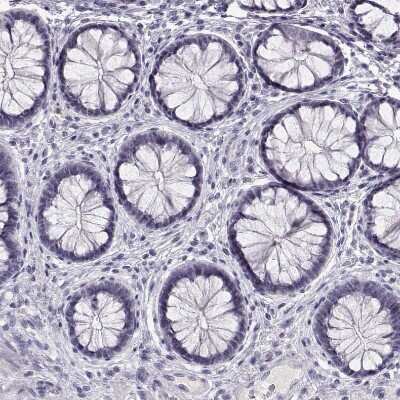 Immunohistochemistry-Paraffin: CRX/CORD2 Antibody [NBP1-88059]