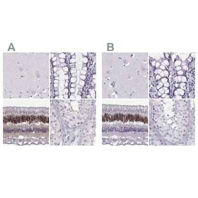 Immunohistochemistry-Paraffin: CRX/CORD2 Antibody [NBP1-88059]