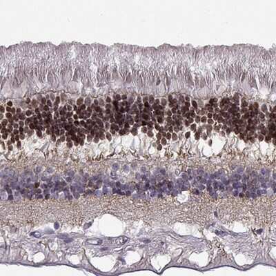 Immunohistochemistry-Paraffin: CRX/CORD2 Antibody [NBP1-88059]