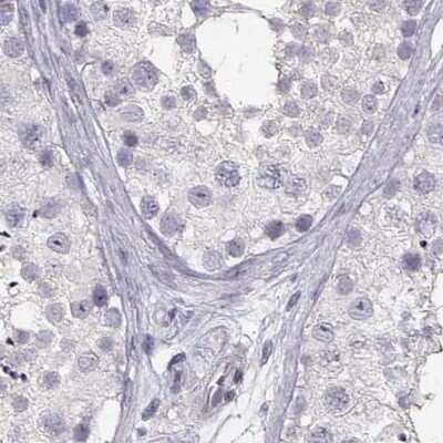 Immunohistochemistry-Paraffin: CRX/CORD2 Antibody [NBP1-88059]