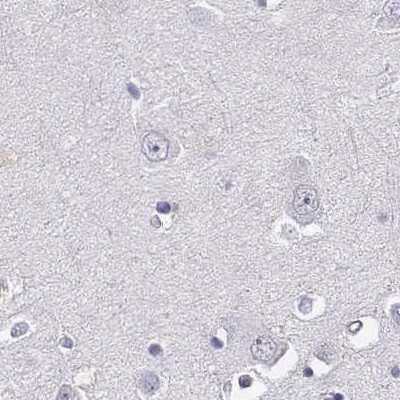 Immunohistochemistry-Paraffin: CRX/CORD2 Antibody [NBP1-88059]