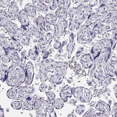 Immunohistochemistry-Paraffin: CRX/CORD2 Antibody [NBP1-88060]