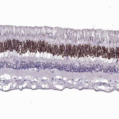 Immunohistochemistry-Paraffin: CRX/CORD2 Antibody [NBP1-88060]