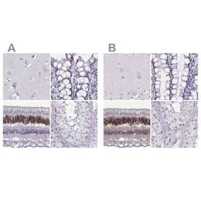 Immunohistochemistry-Paraffin: CRX/CORD2 Antibody [NBP1-88060]